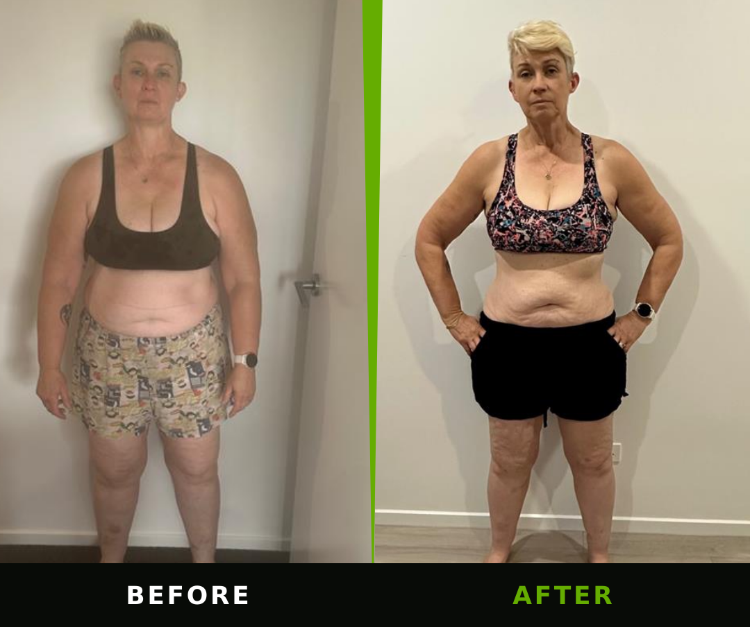 Cath before and after TSN coaching, with before on the left and after on the right